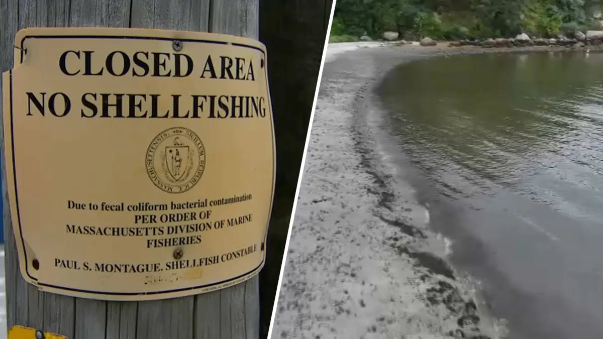 Sintomas de DST: como identificar os sinais no corpo, image size:1280x703