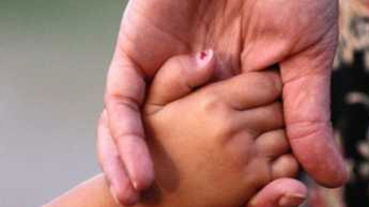 Eu Tenho Tourette, Mas Tourette Não Me Tem backdrop