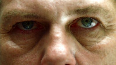 Assistir Dr. House Temporada 3 Episódio 1 Online em HD