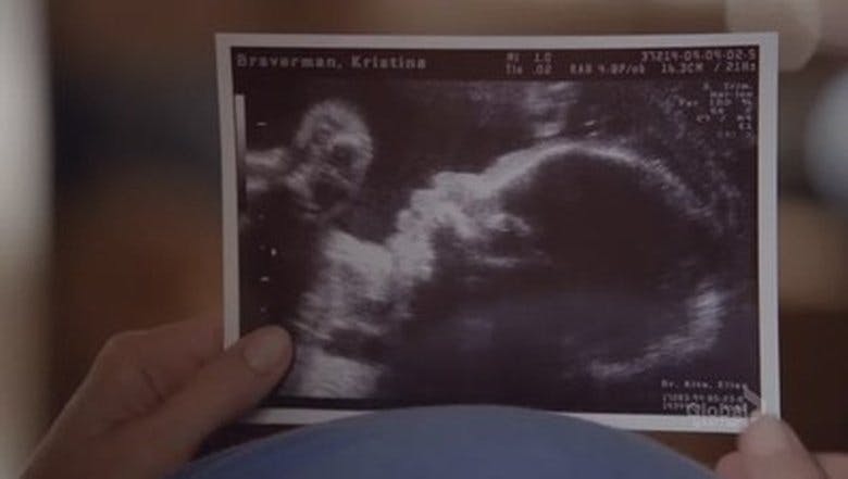 Assistir Parenthood – Minha Família Temporada 3 Episódio 3 Online em HD
