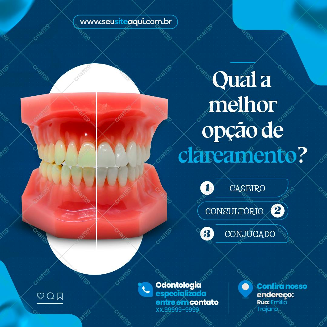 Modelo de Anúncio Odontológico Clareamento Dental PSD Editável