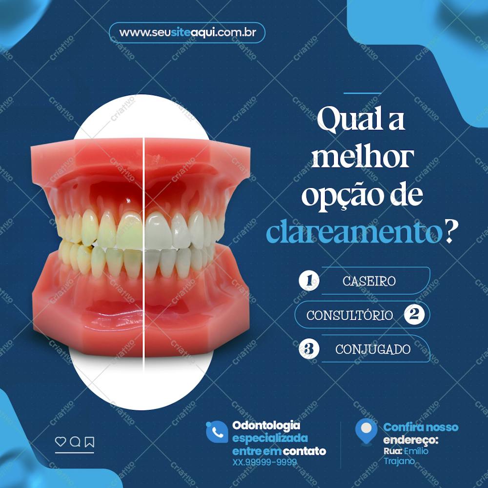 Qual A Melhor Opção De Clareamento?