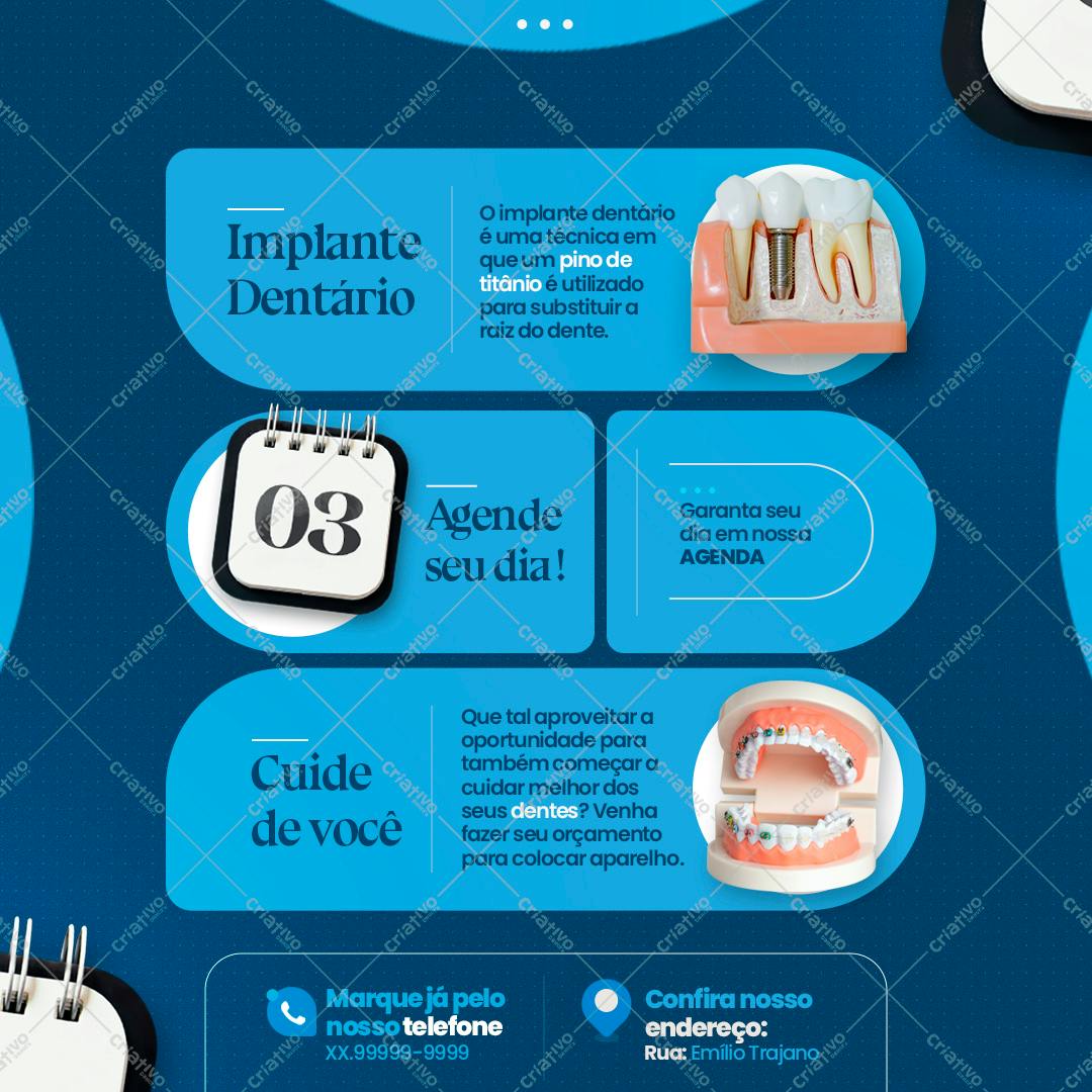 Post para Instagram Implante Dentário PSD Editável