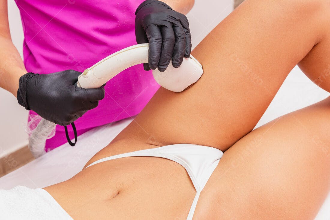Depilação a laser na perna de mulher
