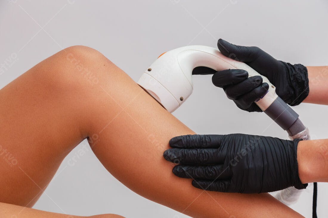 Depilação a laser na perna feminina