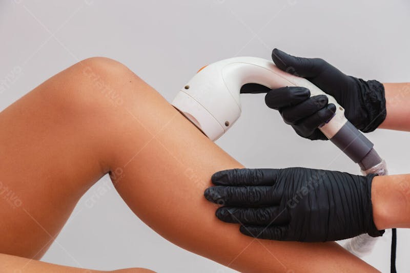 Depilação a laser estética mulher bonita cuidados com a pele pernas 10