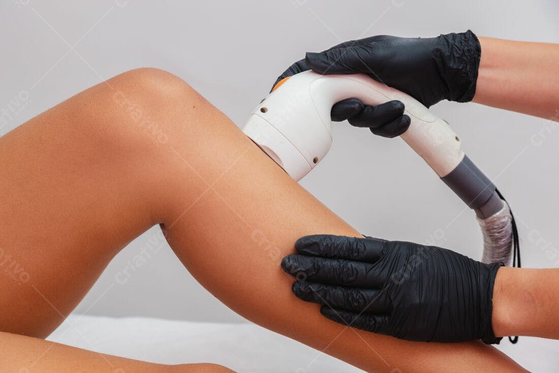 Depilação a laser perna feminina