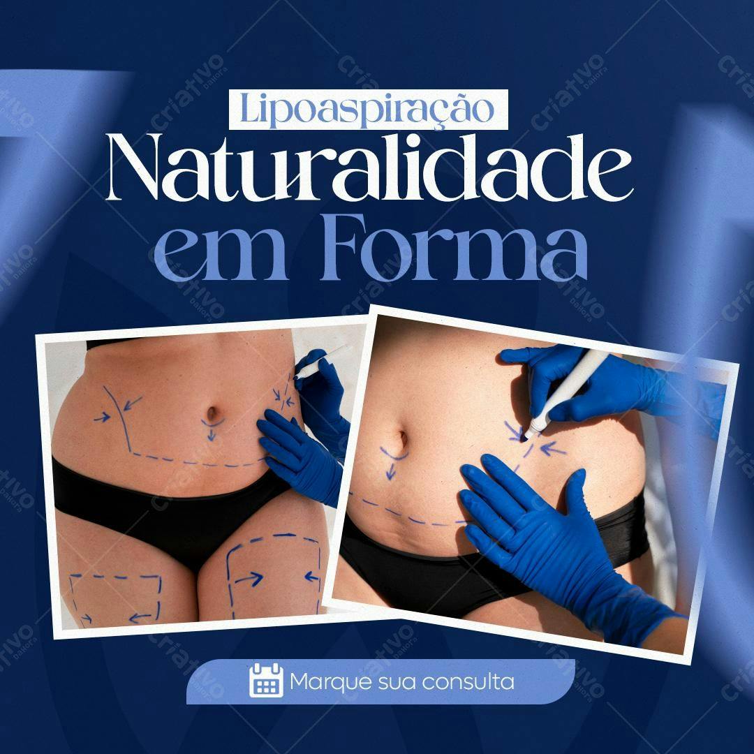 Post para Lipoaspiração PSD Editável