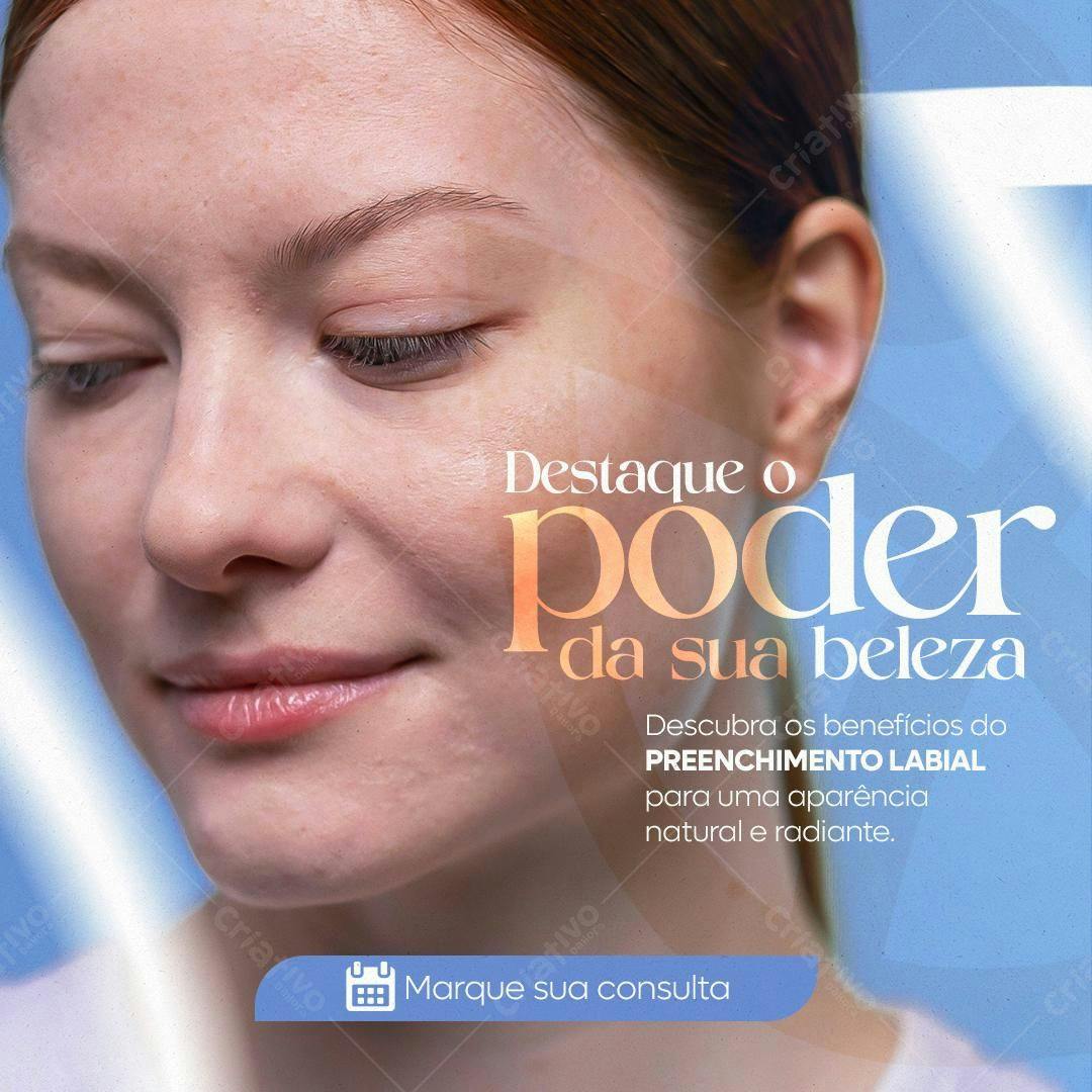 Post para Preenchimento Labial PSD Editável