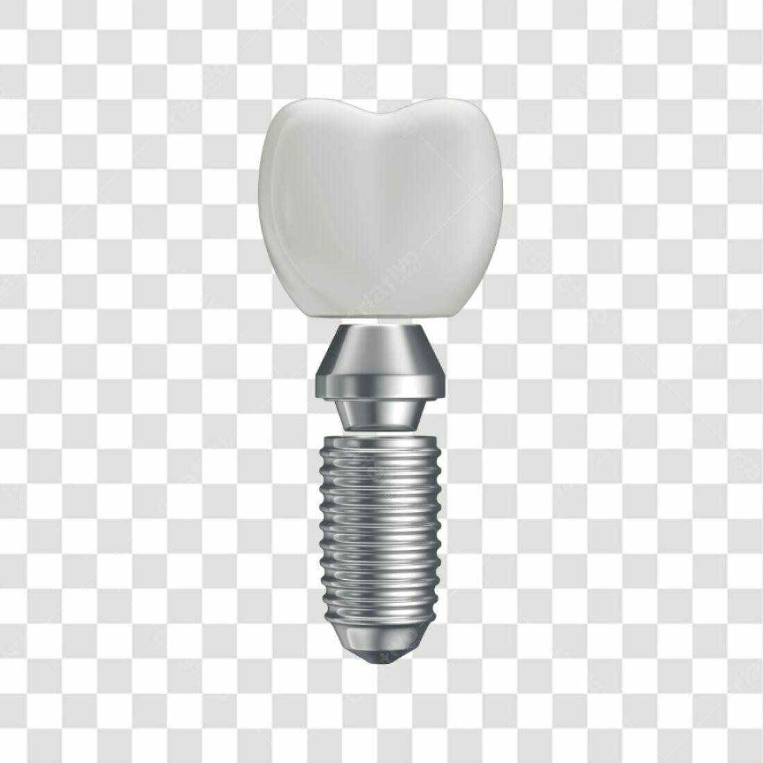 Ícone Dente Implante PNG com fundo transparente