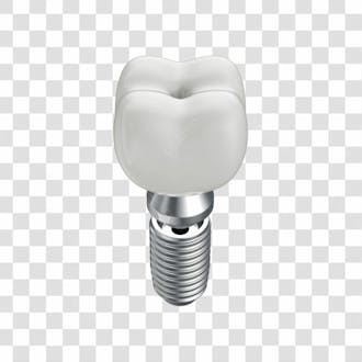 Asset 3d dente em 3d para implante dentário com fundo transparente copiar