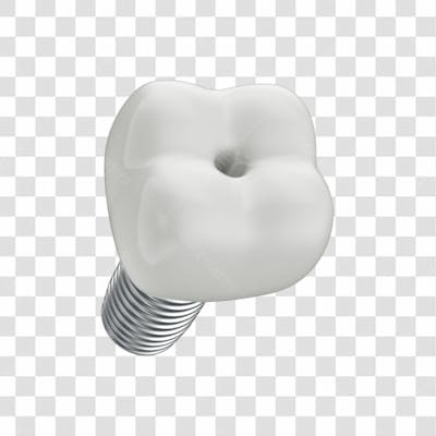 Asset 3D Dente Em 3D Para Implante Dentário Com Fundo Transparente Copiar
