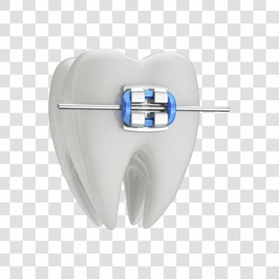 Dente Com Aparelho Em 3D Com Fundo Transparente Copiar