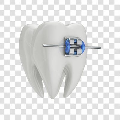 Dente Com Aparelho Em 3D Com Fundo Transparente Copiar