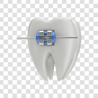 Dente Com Aparelho Em 3D Com Fundo Transparente Copiar