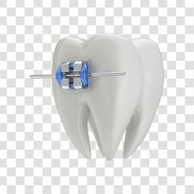 Dente com aparelho em 3d com fundo transparente copiar