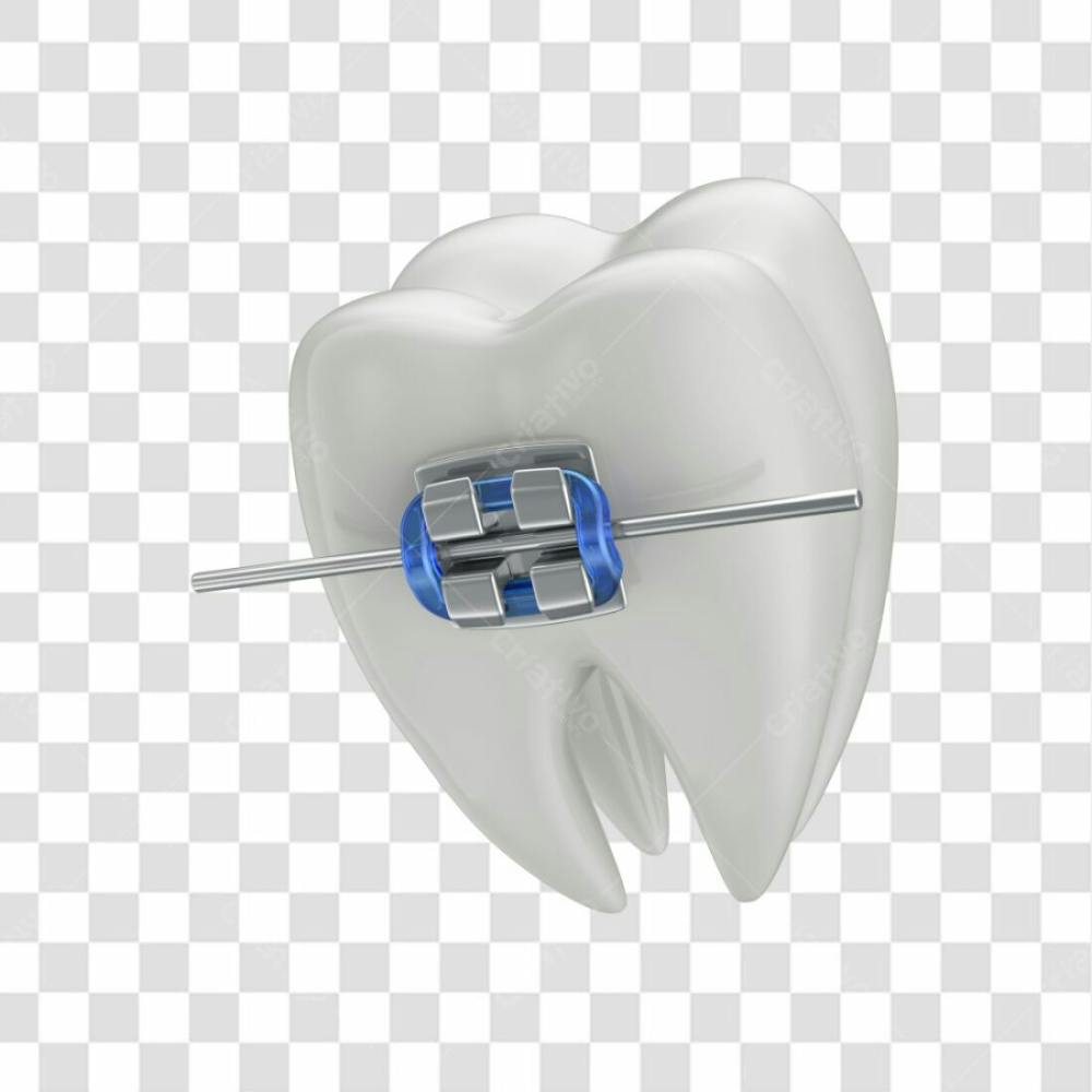 Dente Com Aparelho Em 3D Com Fundo Transparente Copiar