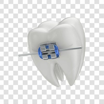 Dente Com Aparelho Em 3D Com Fundo Transparente Copiar