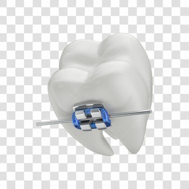 Dente com aparelho em 3d com fundo transparente copiar