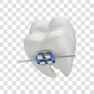 Dente Com Aparelho Em 3D Com Fundo Transparente Copiar