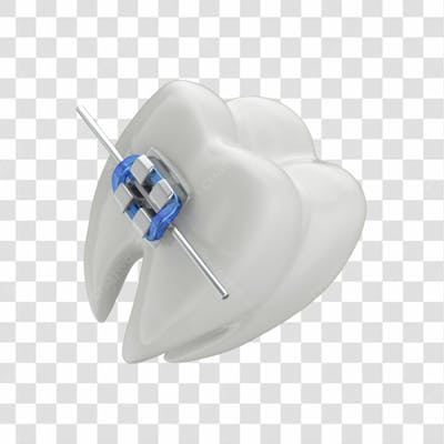 Dente Com Aparelho Em 3D Com Fundo Transparente Copiar