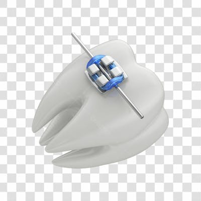Dente Com Aparelho Em 3D Com Fundo Transparente Copiar