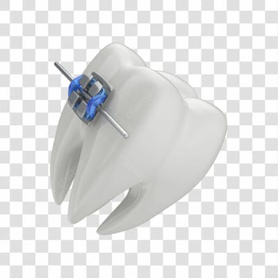 Dente Com Aparelho Em 3D Com Fundo Transparente Copiar