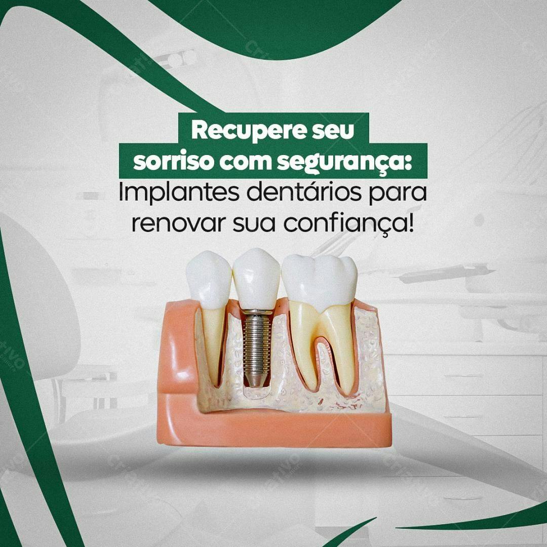 Banner Implantes Dentários PSD Editável