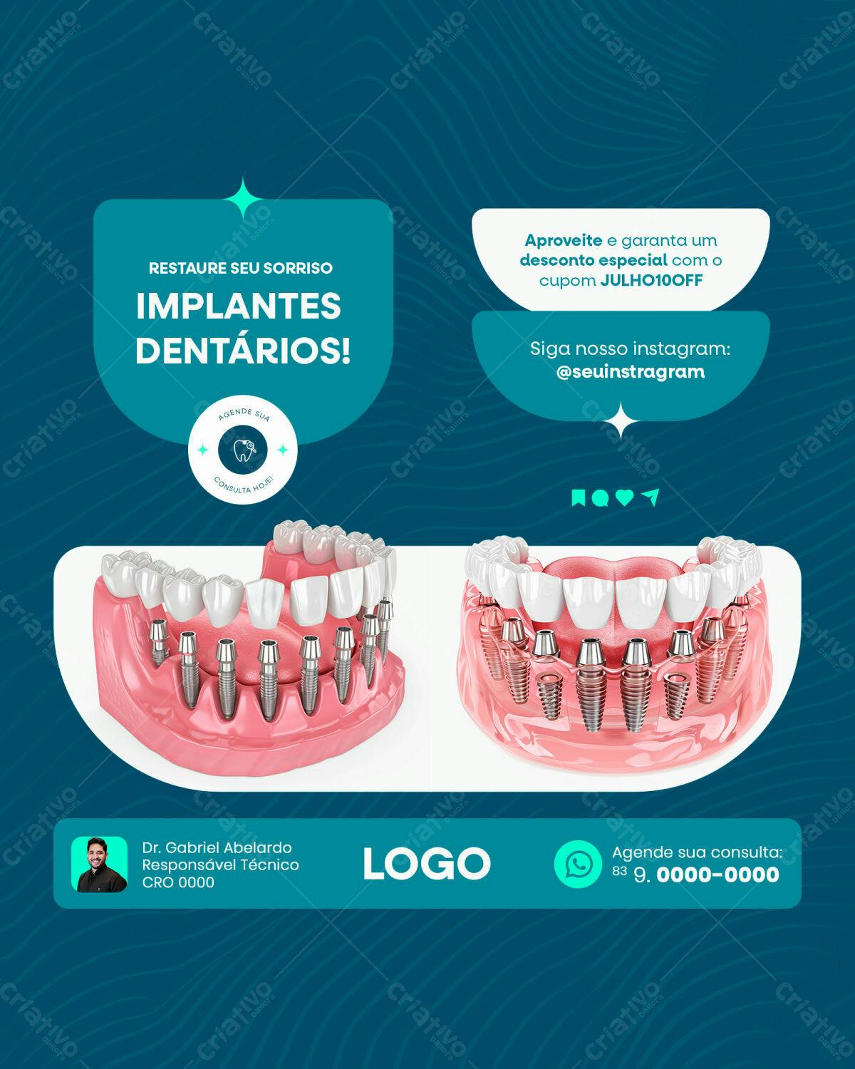 Post Instagram Implantes Dentários PSD Editável