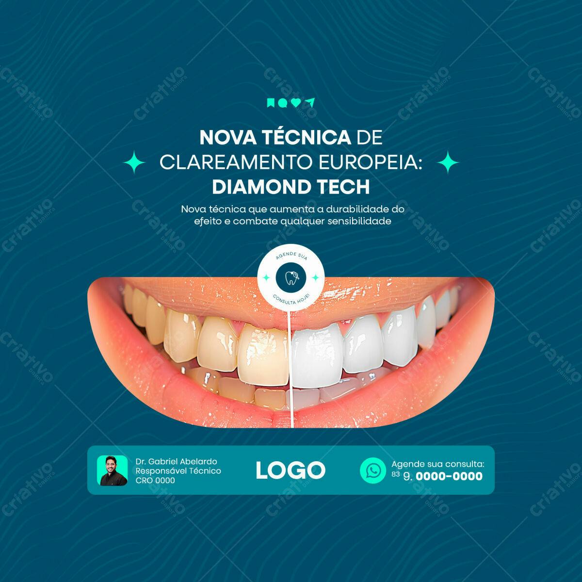 Post para Clareamento Dental PSD Editável