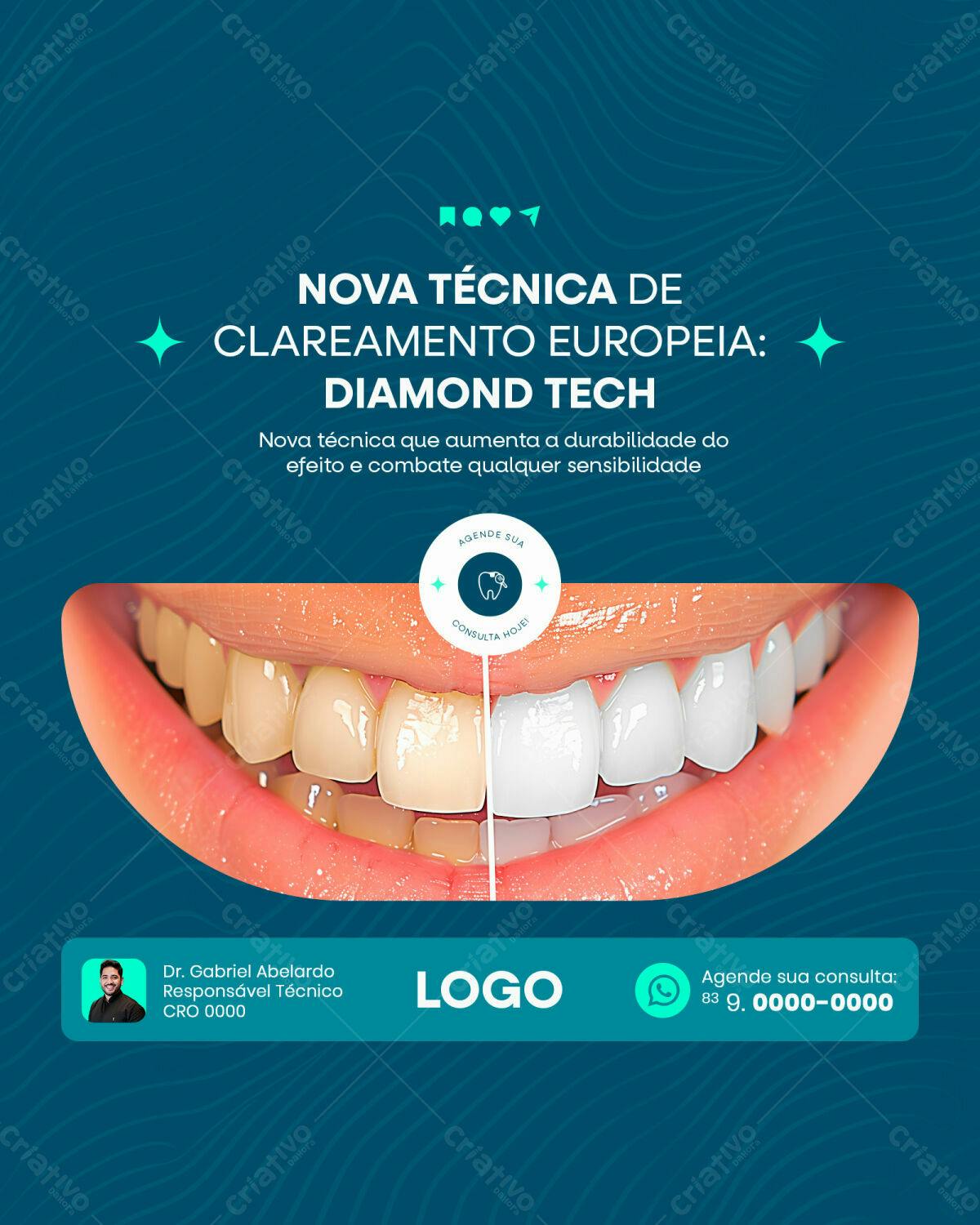 Post para Clareamento Dental PSD Editável
