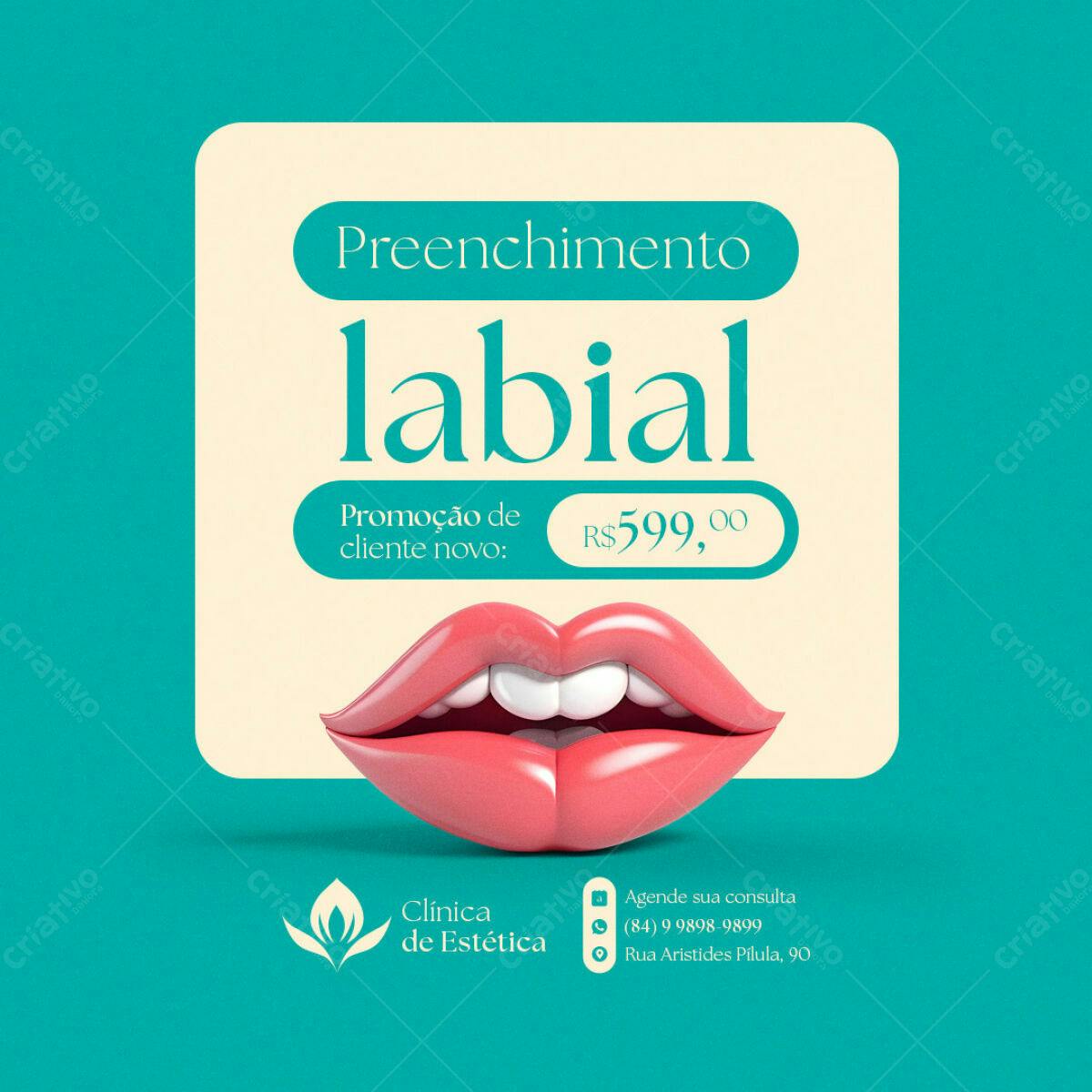 Post para Preenchimento Labial PSD Editável