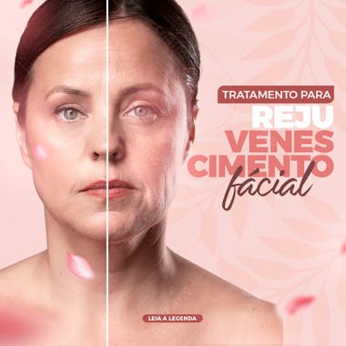 Tratamento para rejuvenescimento facial