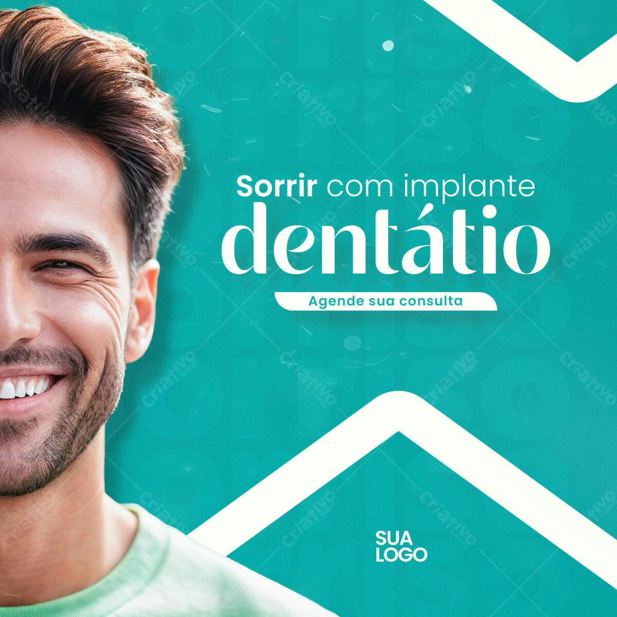 Post para Implante Dentário PSD Editável
