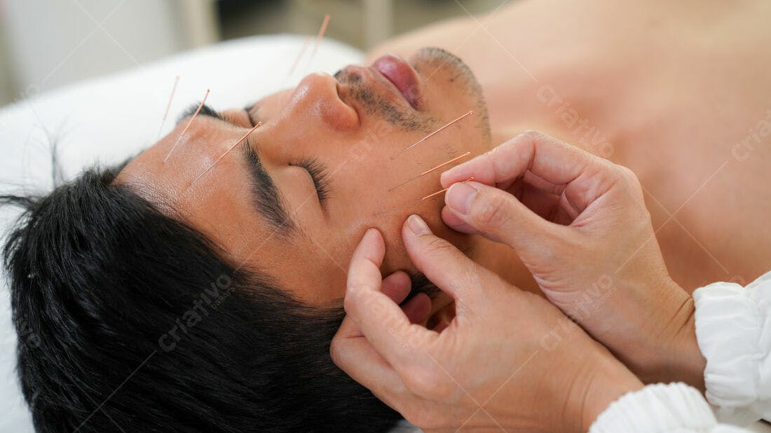 Acupuntura facial homem asiático