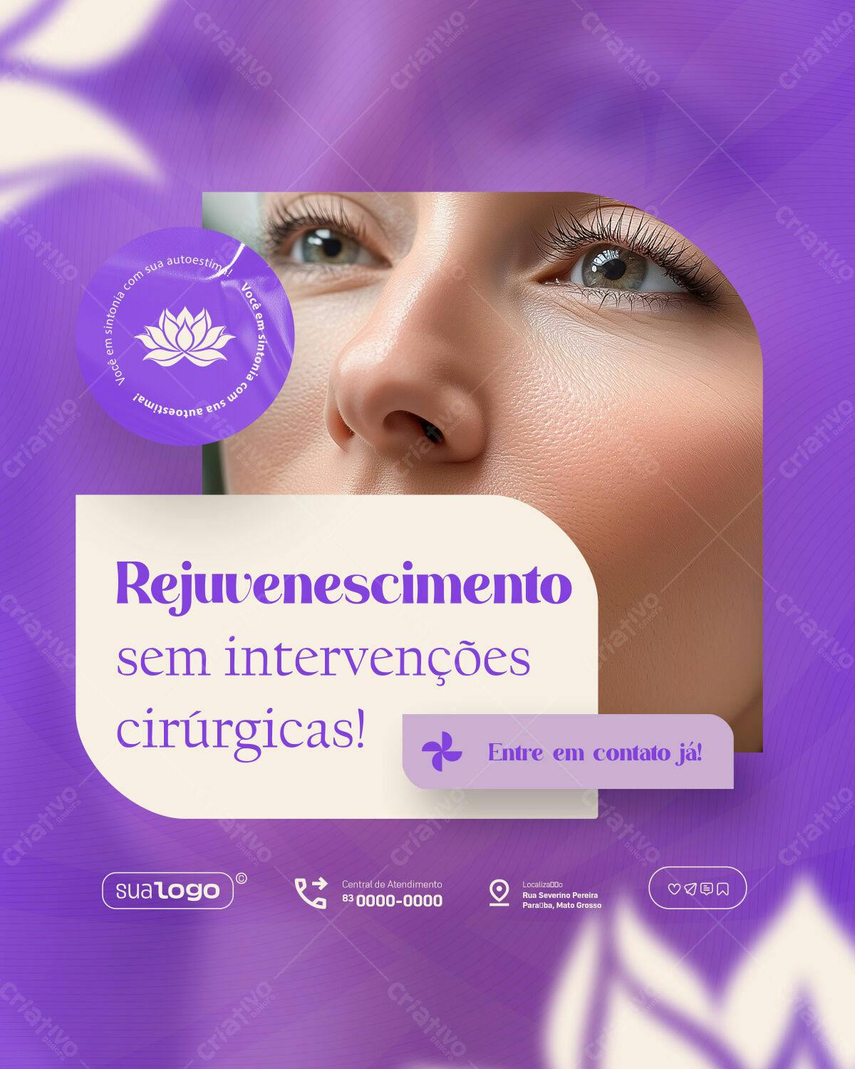 Post para Clínica de Estética PSD Editável