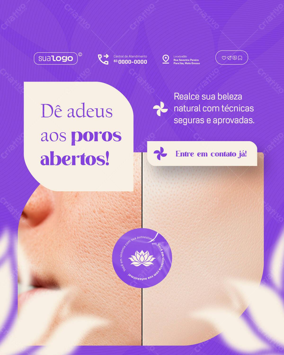 Post para Redes Sociais Skincare PSD Editável