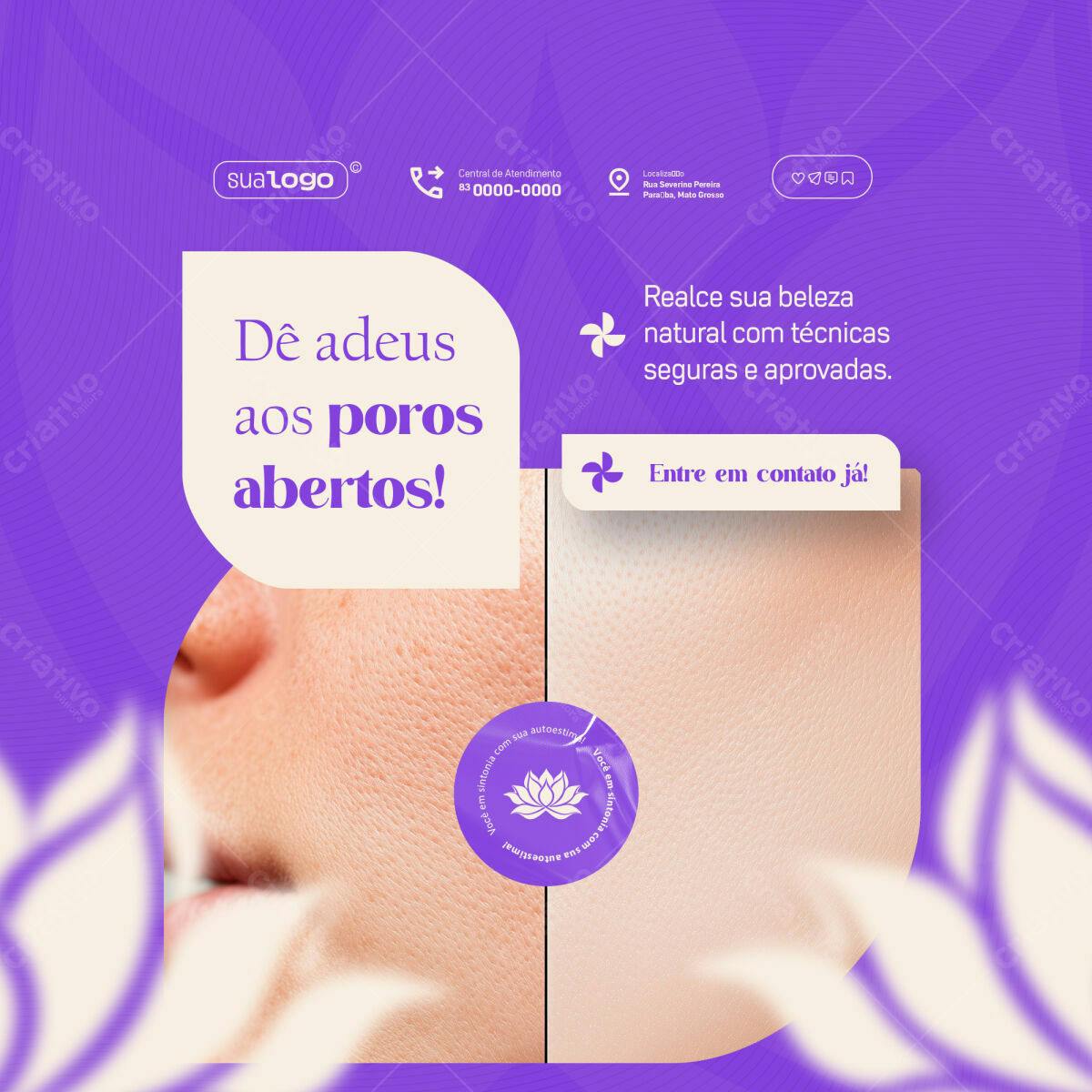 Post para Redes Sociais PSD Editável - Tratamento de Pele