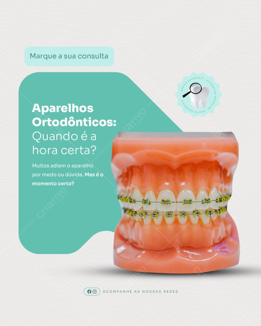Post para Instagram sobre Aparelhos Ortodonticos PSD Editável