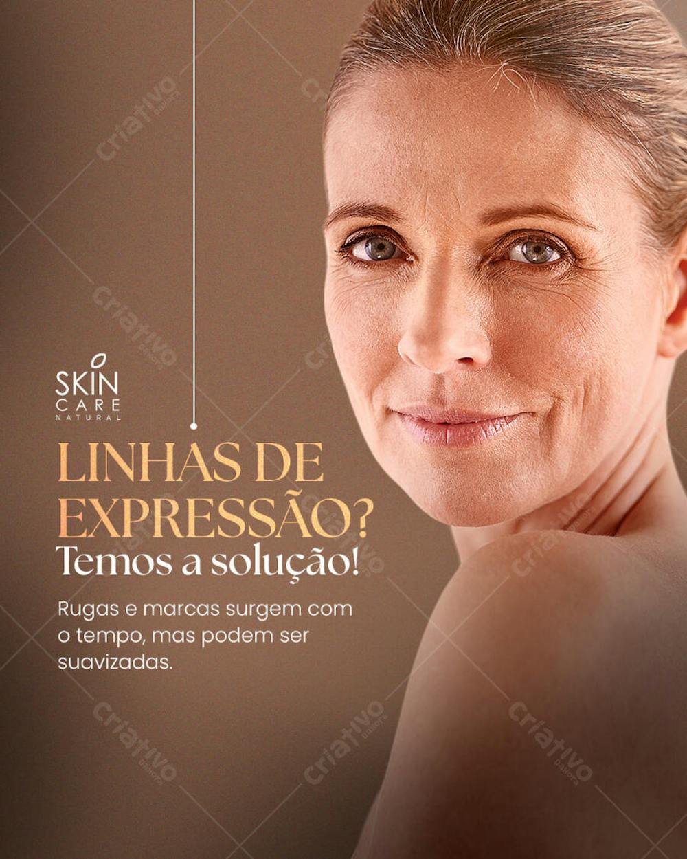 Social  media Estética 