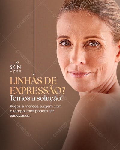 Social  media Estética 