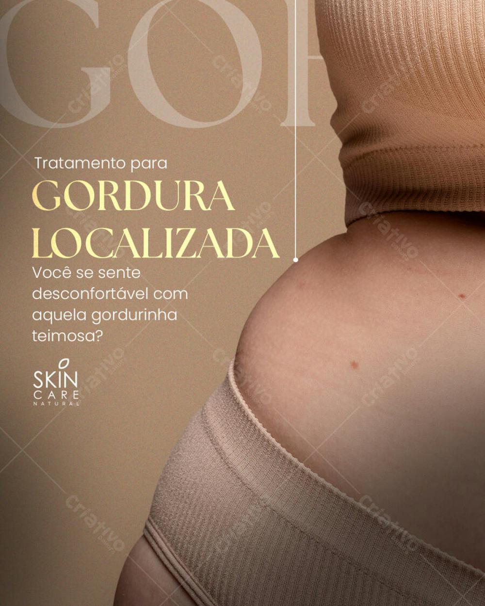 Social  media Estética 