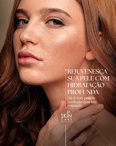 Social  media Estética 