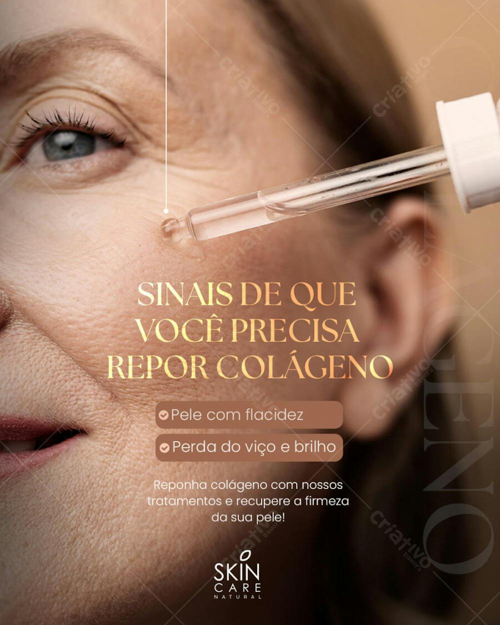 Social  media Estética 