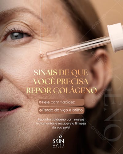 Social  media Estética 