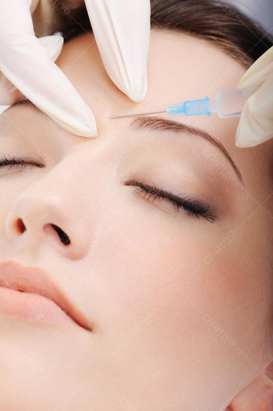 Aplicação de Botox na Testa de Mulher