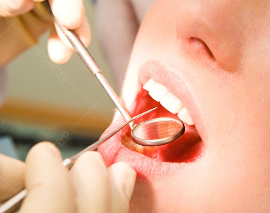 Exame dentário com espelho bucal