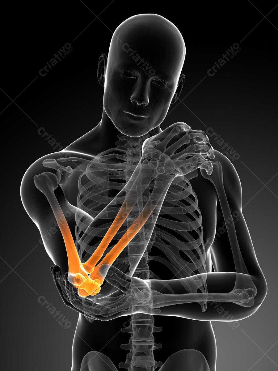 Dor no cotovelo anatomia 3D