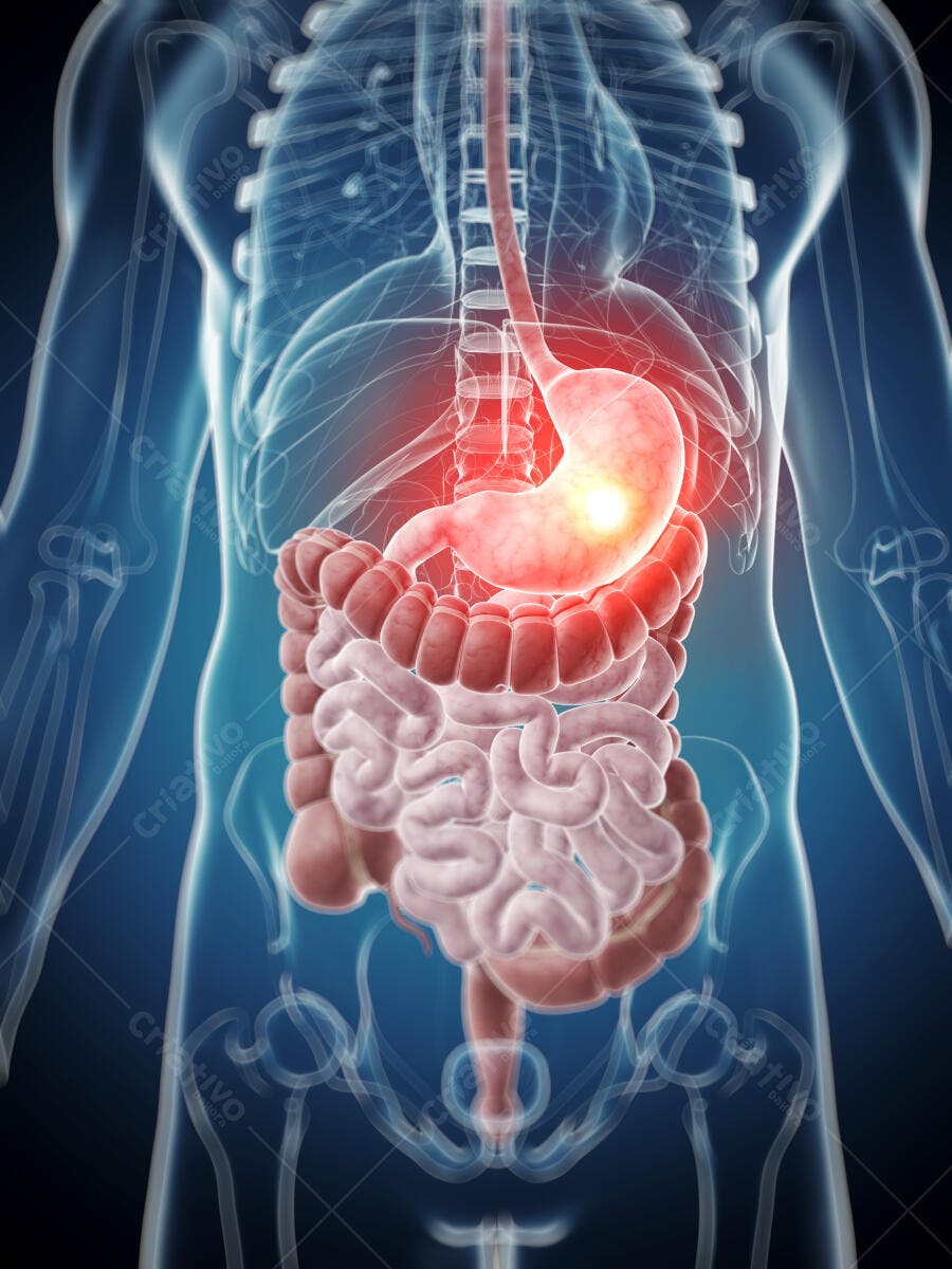 Estômago inflamado sistema digestivo humano