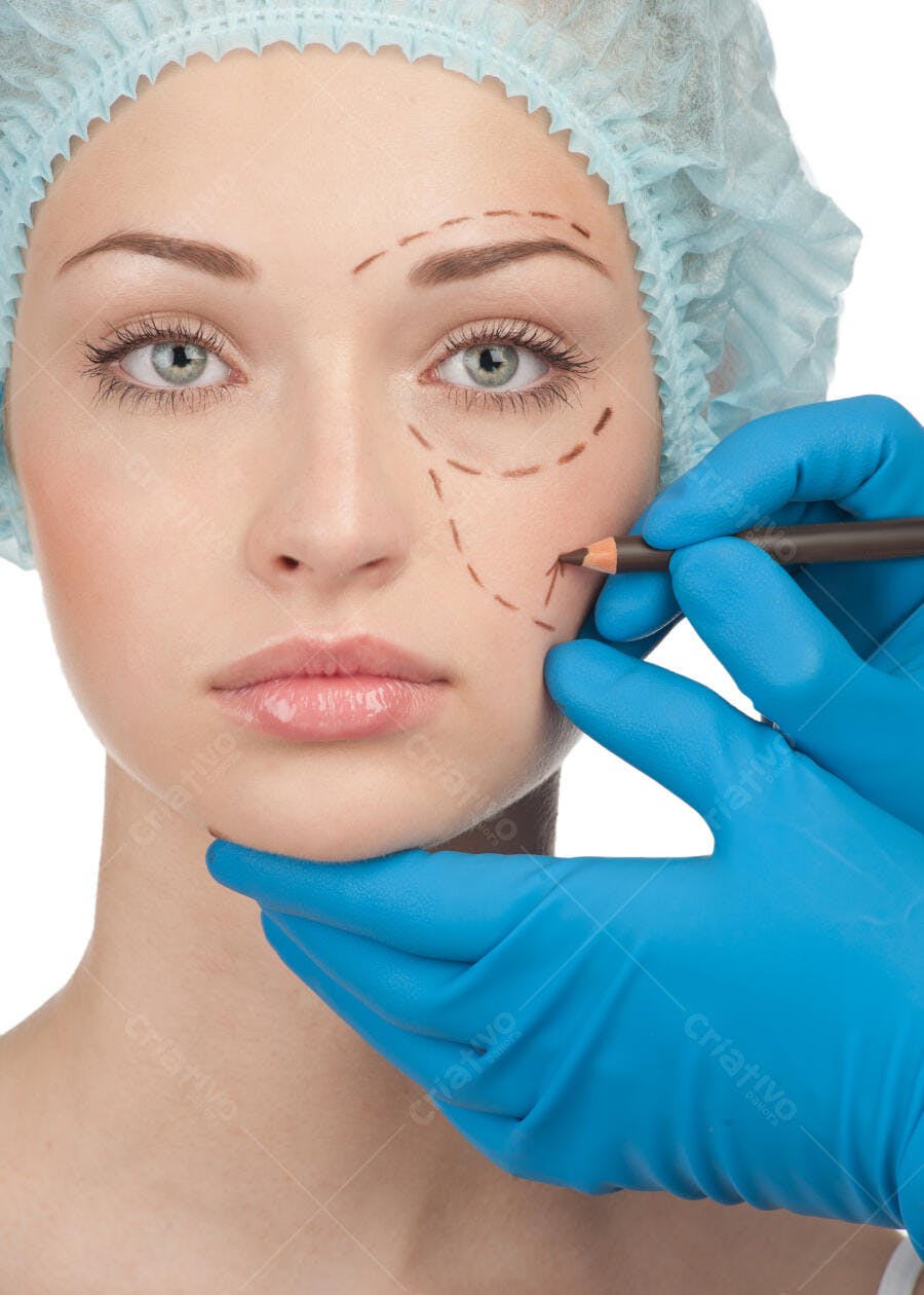 Marcações Pré-Cirurgia Facial em Mulher